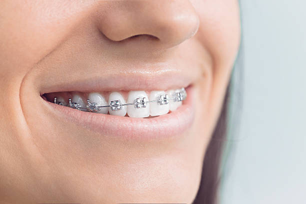 Best Dental Bonding  in Damascus, OR